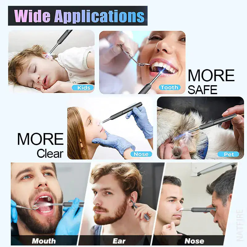 Wireless Smart Visual Ear Wax Removal Cleaner