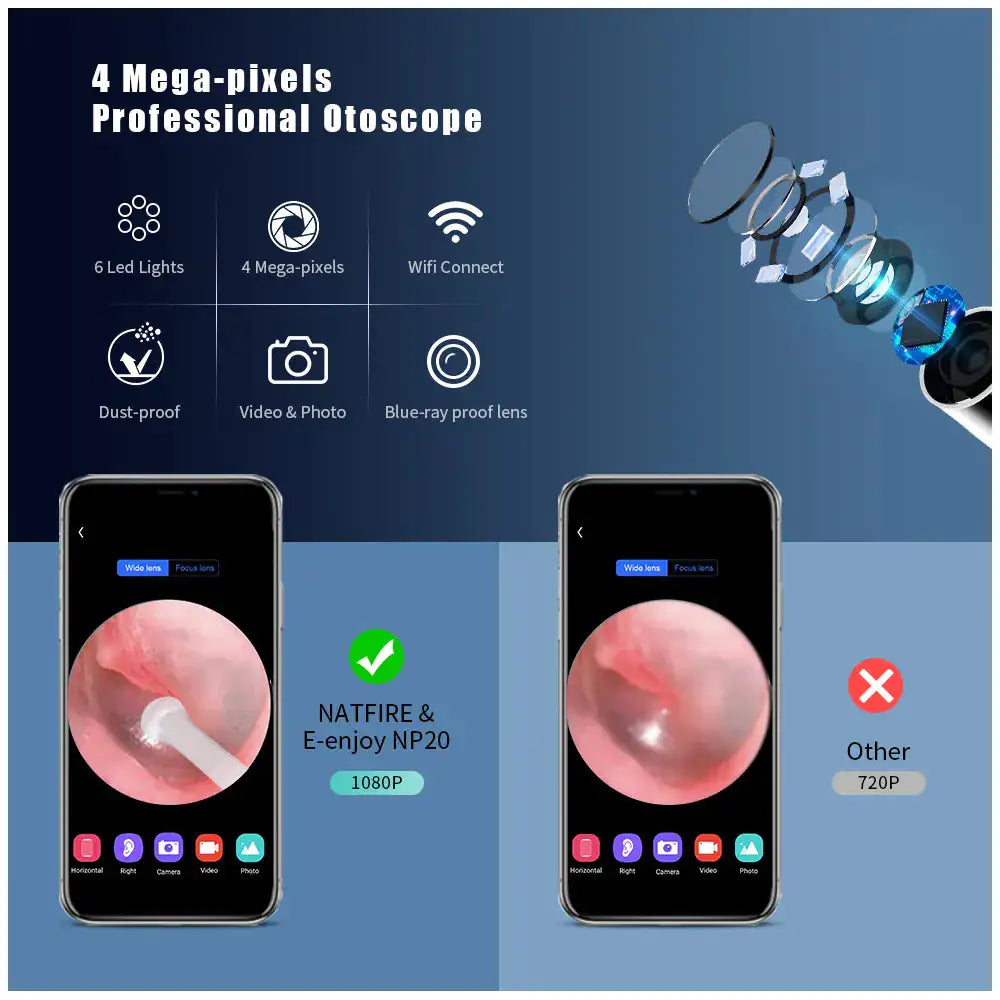 Wireless Smart Visual Ear Wax Removal Cleaner