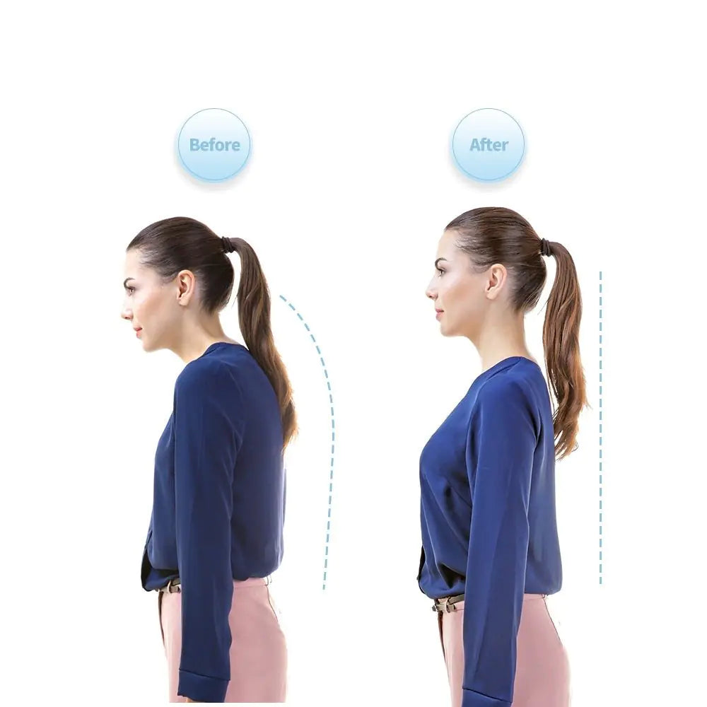 Smart Posture Neck Hump Corrector